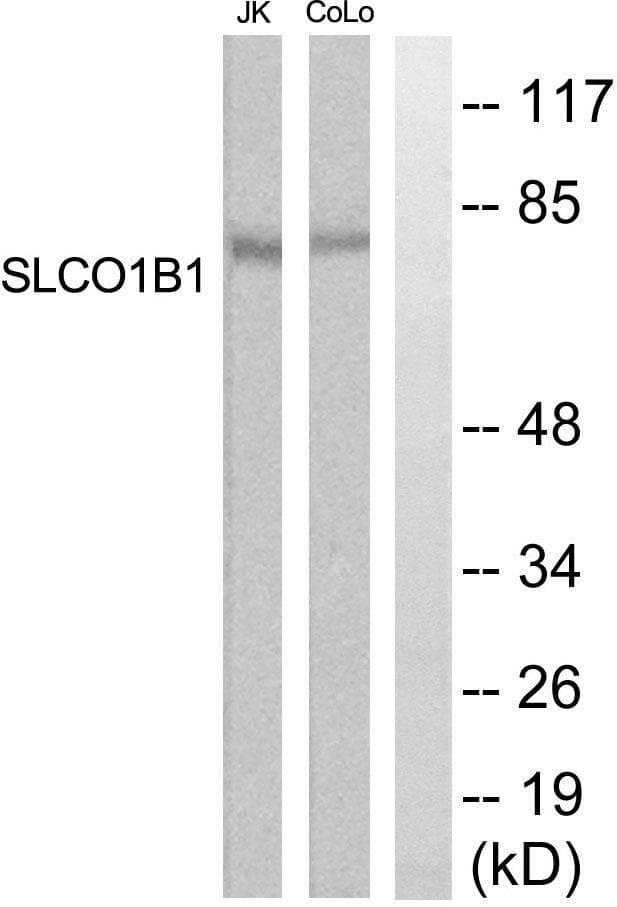 SLCO1B1 / OATP2 Antibody