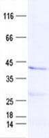 Human ADAT3 Protein (Recombinant His, N-Terminal)