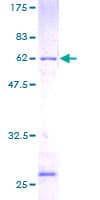 Human RPLP0 Protein (Recombinant GST)