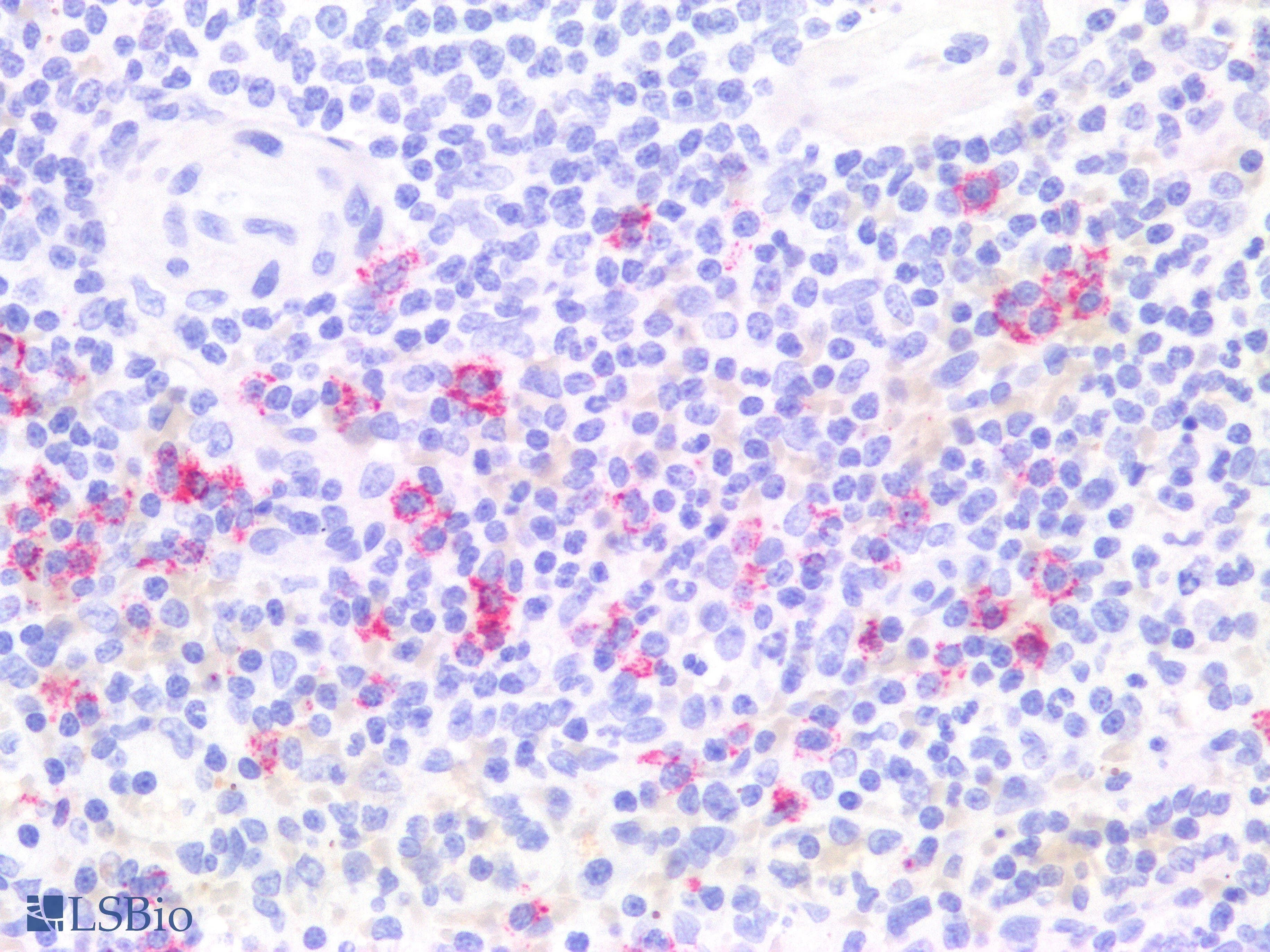 PathPlus™ Monoclonal Mouse anti-Human Hairy Cell Leukemia Antibody (Concentrated, IHC)