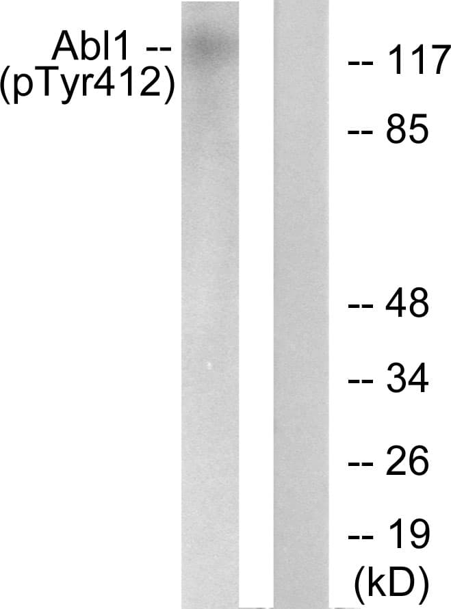 ABL1 / c-ABL Antibody (phospho-Tyr412)