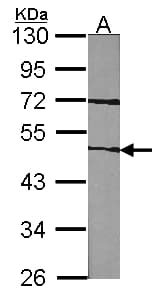 IHC-plus™ Polyclonal Rabbit anti-Human F7 / Factor VII Antibody (IHC, WB)
