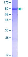 Human CASC4 Protein (Recombinant GST)