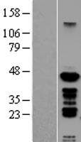 PSMC6 Protein (Over-Expression Lysate Myc-DDK (Flag))