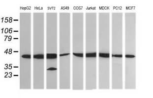 MAP2K1 / MKK1 / MEK1 Antibody (clone OTI6C6)