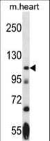 NEK9 Antibody (aa503-530)