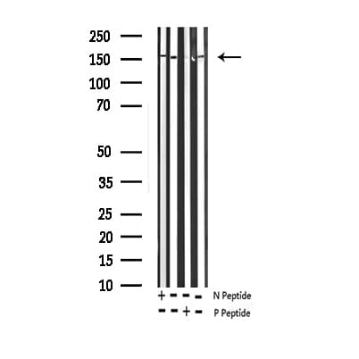 EGFR Antibody (phospho-Thr693)