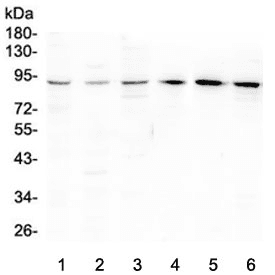BCL6 Antibody