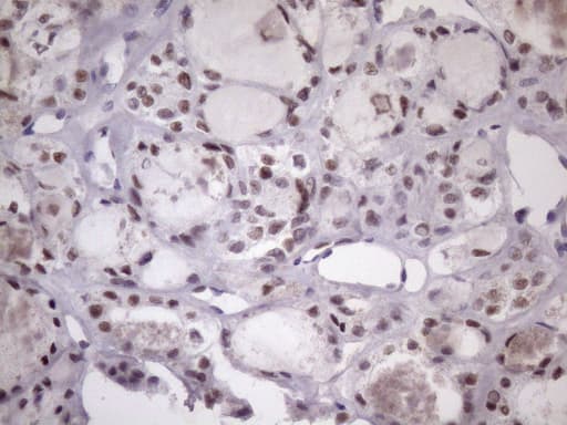 SRSF9 / SFRS9 Antibody (clone OTI5G7)
