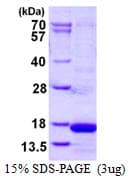 Human CST4 / Cystatin S Protein (Recombinant His)