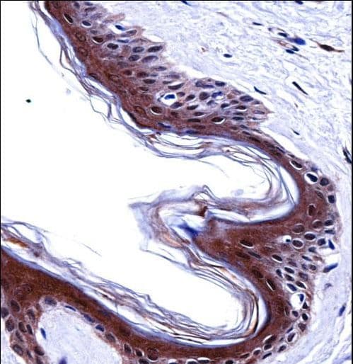 SMARCE1 / BAF57 Antibody (aa307-335)