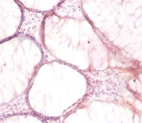 ATP6V1G1 / ATP6J Antibody