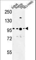 BCL11A Antibody (aa806-835)