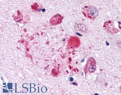 PathPlus™ GPER1 / GPR30 Antibody (N-Terminus)