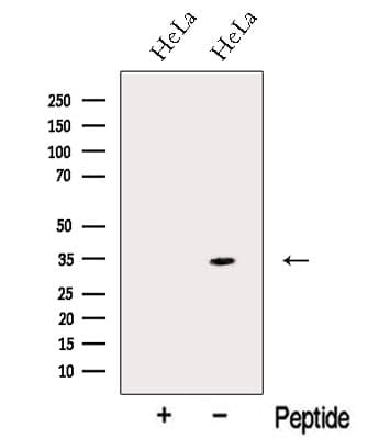 NMRAL1 / HSCARG Antibody