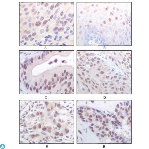 MYST1 Antibody