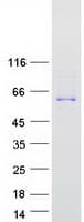 Human TTC39C Protein (Recombinant Myc-DDK (Flag))