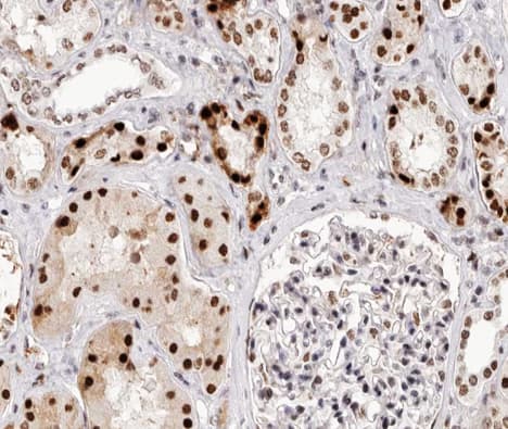BCL2 / Bcl-2 Antibody (phospho-Thr69)
