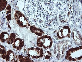 LGALS3 / Galectin 3 Antibody (clone OTI1A3)