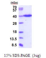 Human ERGIC3 Protein (Recombinant His)