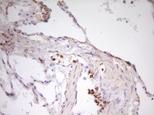 Monoclonal Mouse anti-Human MED15 / ARC105 Antibody (clone OTI1H5, aa393-679, IHC, WB)