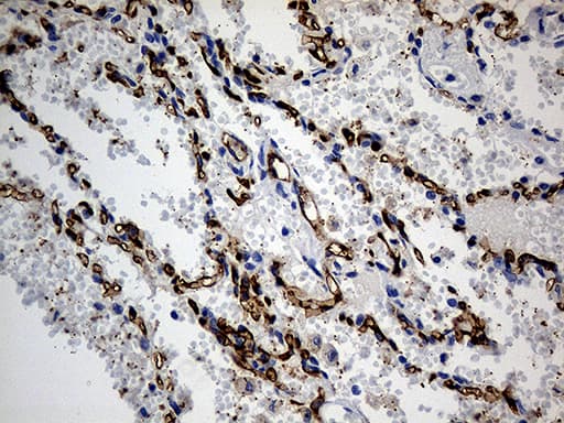 ACE / CD143 Antibody (aa642-1230, clone OTI2G5)
