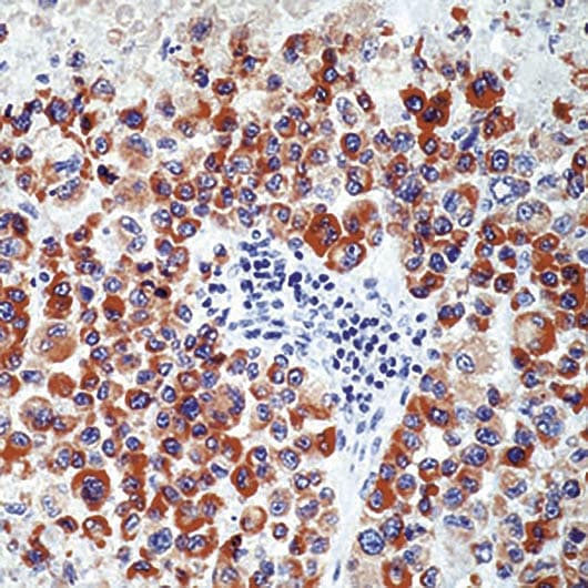 Monoclonal Mouse anti-Human Tyrosinase Antibody (clone T311, IHC, WB)