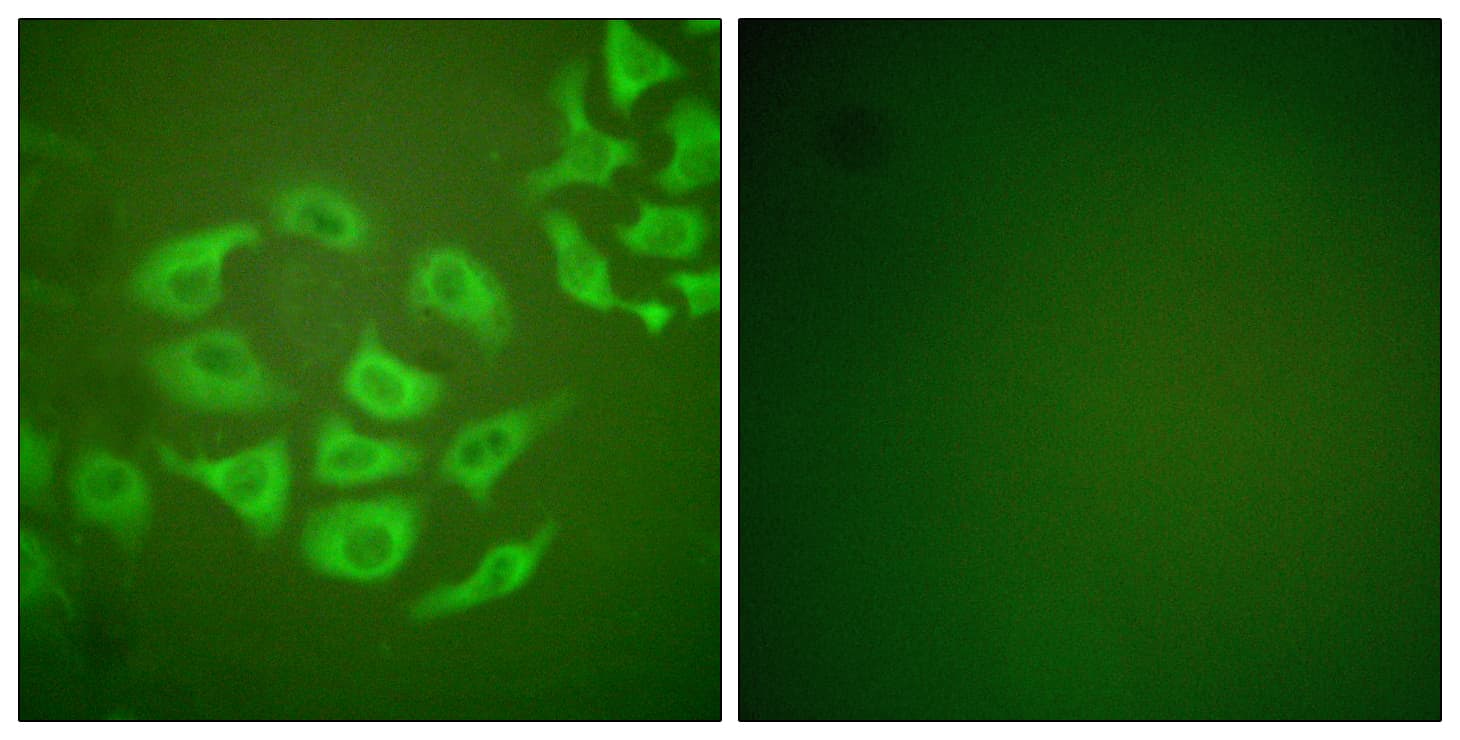 MMP10 Antibody (aa361-410)
