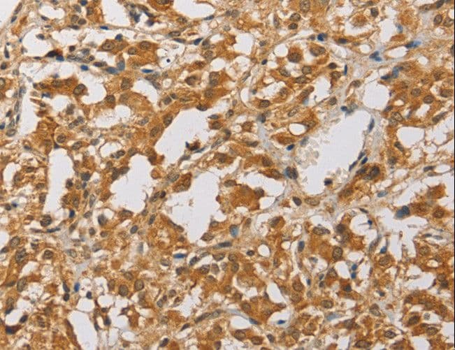 Polyclonal Rabbit anti-Human ARHGEF5 Antibody (IHC)