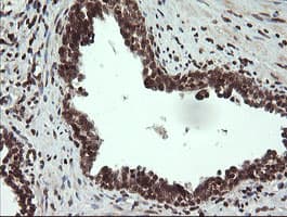 FAM164A / CGI-62 Antibody (clone OTI4B5)