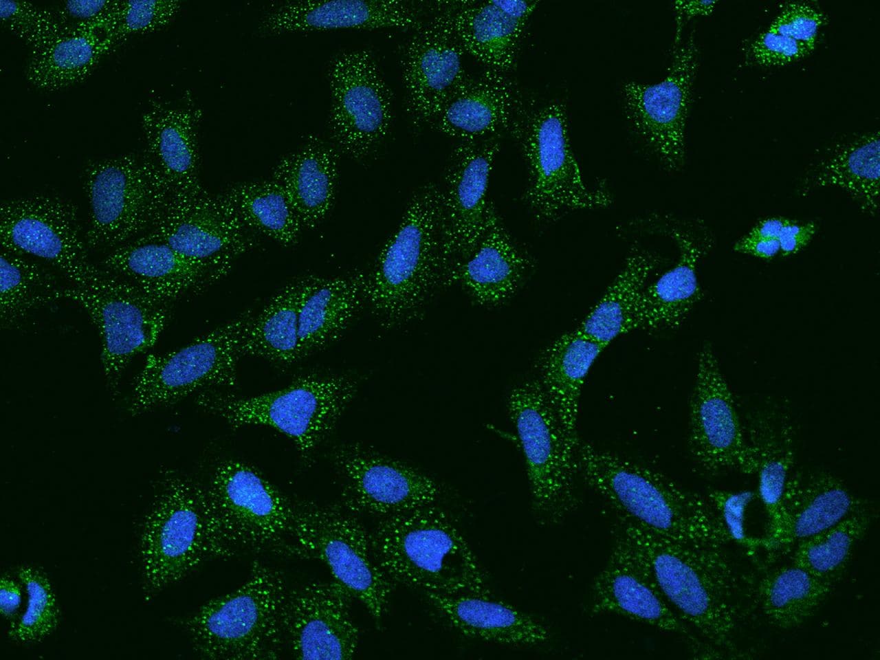 SCCPDH Antibody