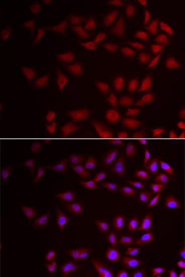 Polyclonal Rabbit anti-Human CIRP / CIRBP Antibody (IHC, IF, WB)