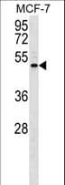 ENPP5 Antibody (aa404-431)