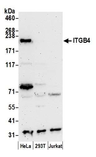 ITGB4 / Integrin Beta 4 Antibody (aa1772-1822)