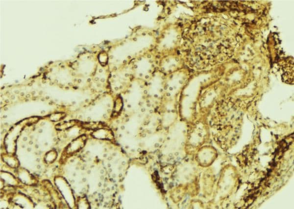 WT1 / Wilms Tumor 1 Antibody