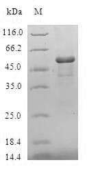 Human GSTZ1 Protein (Recombinant GST, N-terminus)