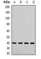 Polyclonal Rabbit anti-Human DYNC2LI1 / D2LIC Antibody (WB)