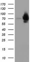 HSPA6 / HSP70B' Antibody (clone OTI2C2)