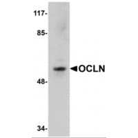 PathPlus™ OCLN / Occludin Antibody