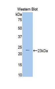 PYGL Antibody (aa370-538, Biotin)