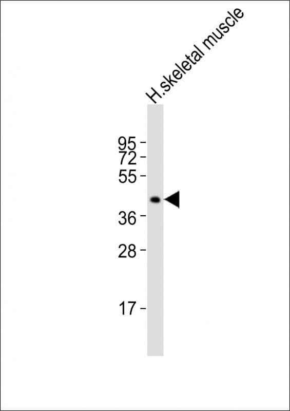 Polyclonal Rabbit anti-Human CDX4 Antibody (aa181-214, WB)