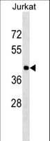 HLA-C Antibody (aa66-93)