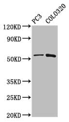 Polyclonal Rabbit anti-Human CAPS2 Antibody (IHC, WB)