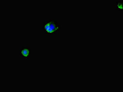LPAL2 Antibody