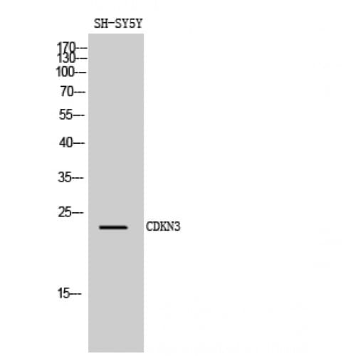 Polyclonal Rabbit anti-Human CDKN3 / KAP Antibody (1-80 aa, Internal, IHC, WB)