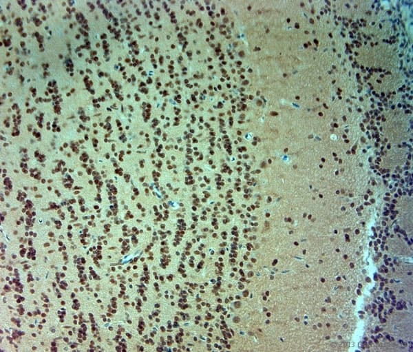 ARX Antibody (aa2-50)