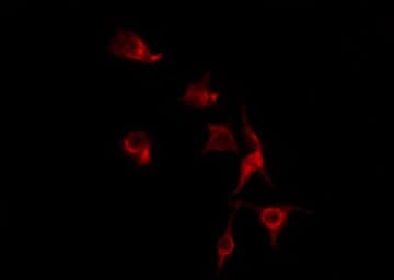 Polyclonal Rabbit anti-Human SFRS7 / 9G8 Antibody (IF, WB)