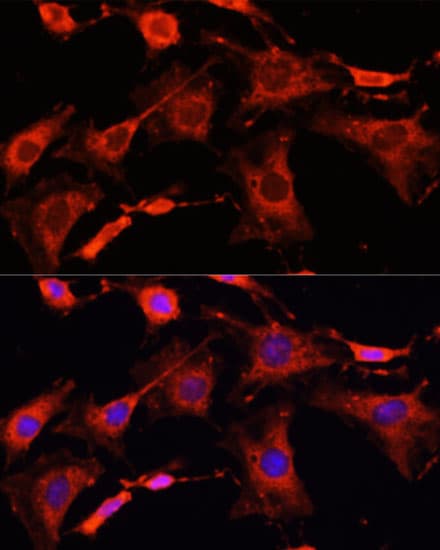 IRAK1 / IRAK Antibody