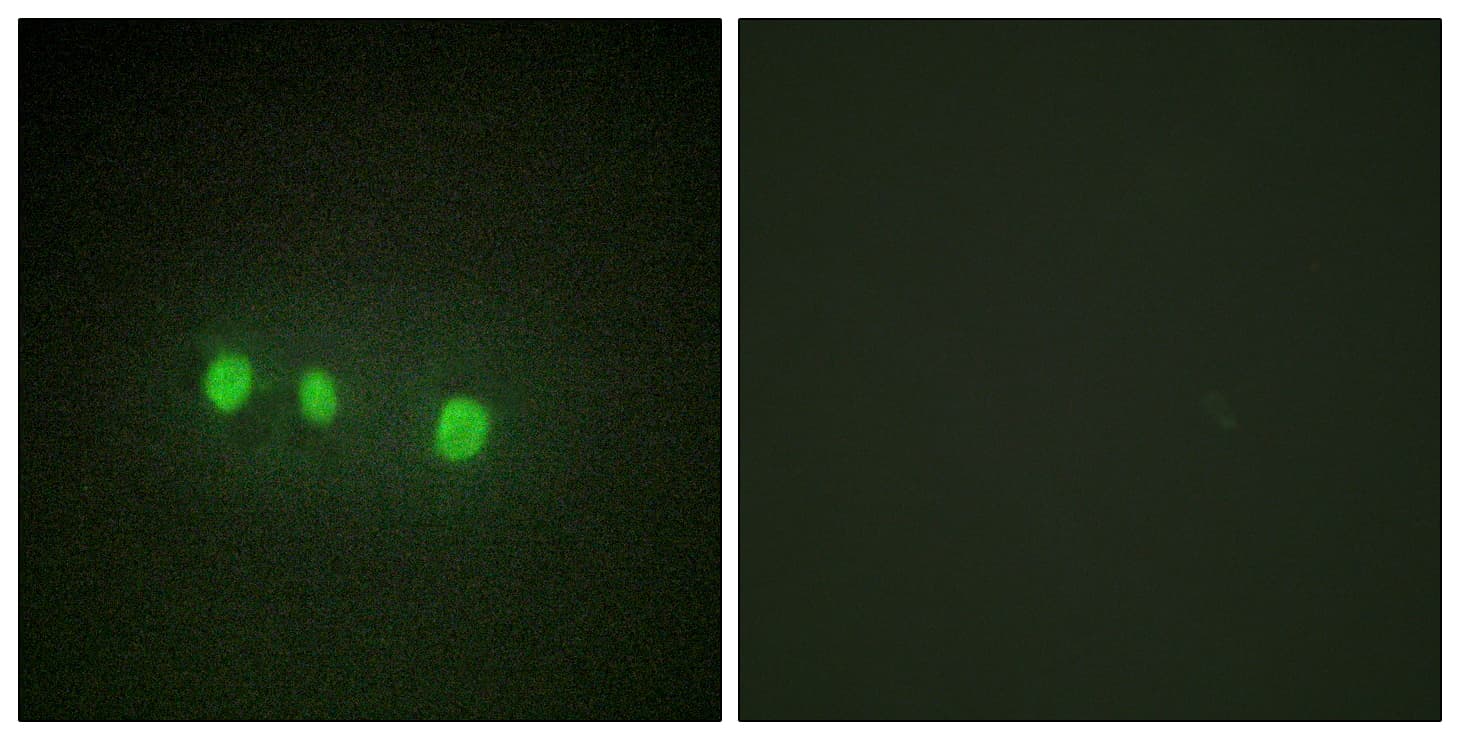 Polyclonal Rabbit anti-Human ZIC1+2+3+4+5 Antibody (aa281-330, IF)