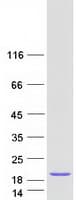 Human SRP14 Protein (Recombinant Myc-DDK (Flag))